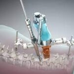 robotic spine surgery