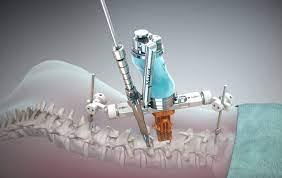 robotic spine surgery