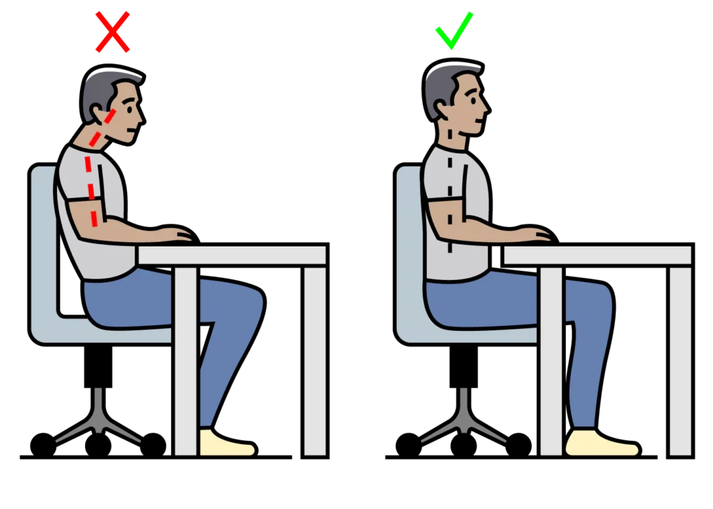 Cervical Radiculopathy