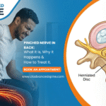 Pinched Nerve in Back