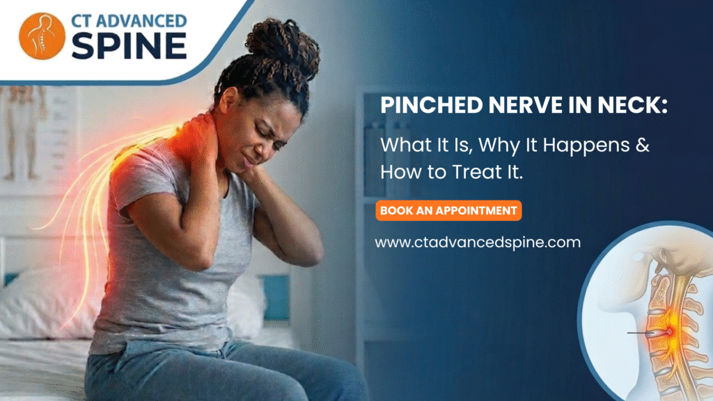 Pinched Nerve in Neck
