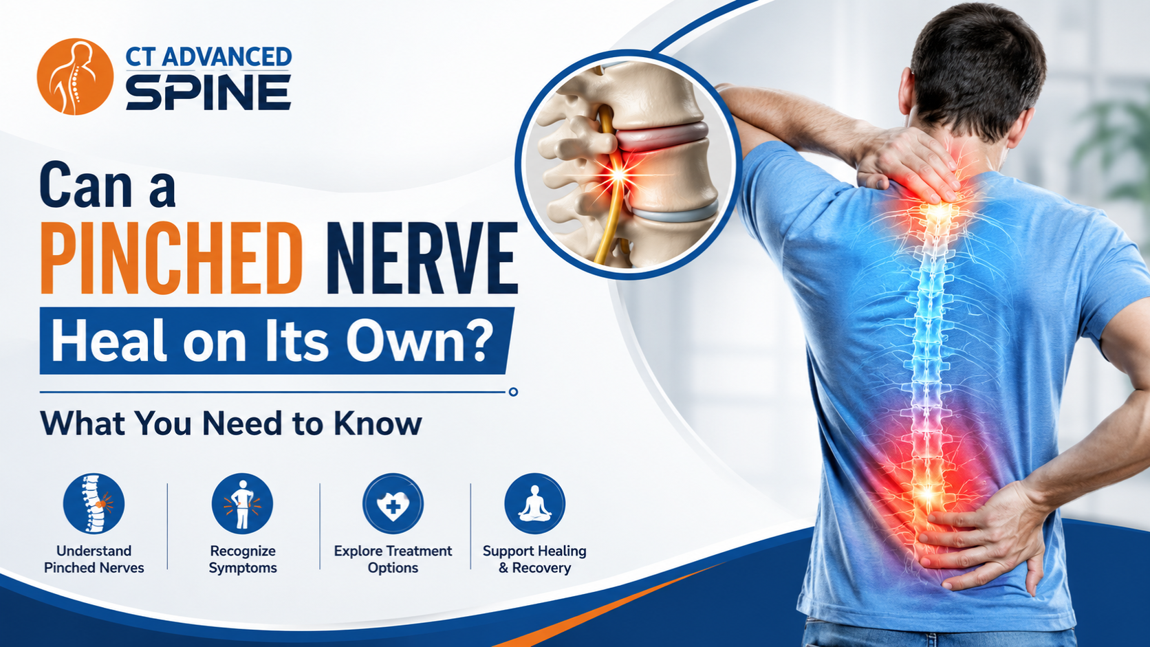 Can a Pinched Nerve Heal on Its Own? What You Need to Know